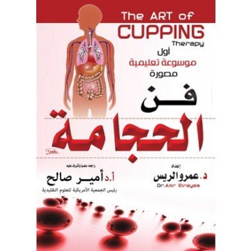 فن الحجامة