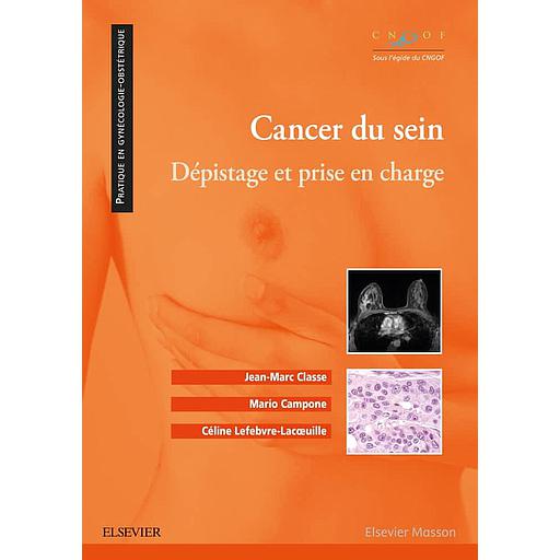 Cancer du sein  - Dépistage et prise en charge