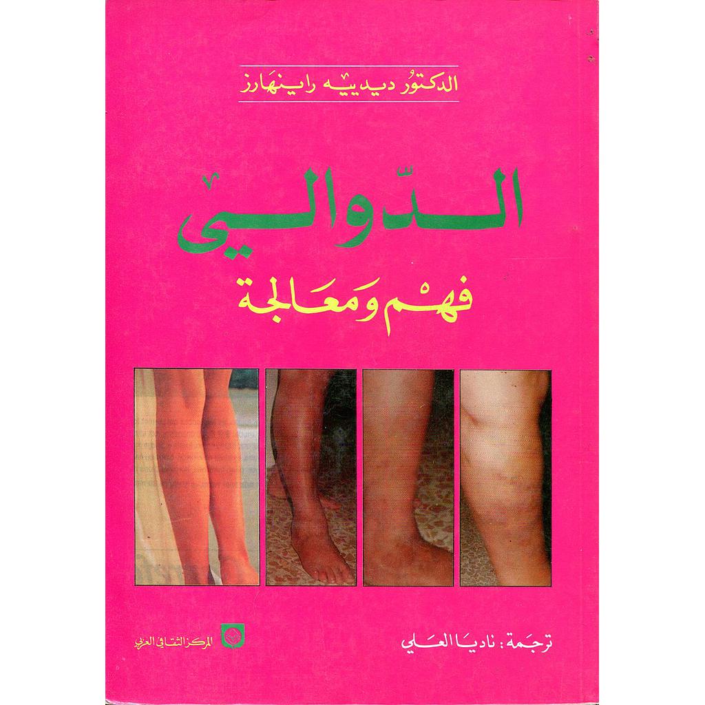 الدوالي فهم ومعالجة