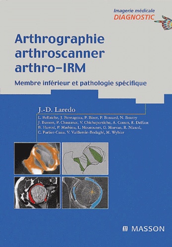 Arthrographie, Arthroscanner, Arthro-Irm. Membre Inferieur Et Pathologie Specifique
