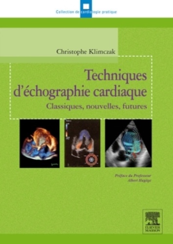 Techniques d'échographie cardiaque  - Classiques, nouvelles, futures