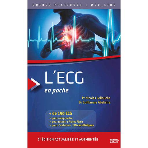 L'ECG en poche