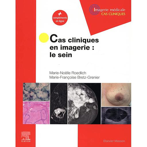 Cas cliniques en imagerie  - Le sein