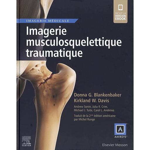 Imagerie musculosquelettique traumatique