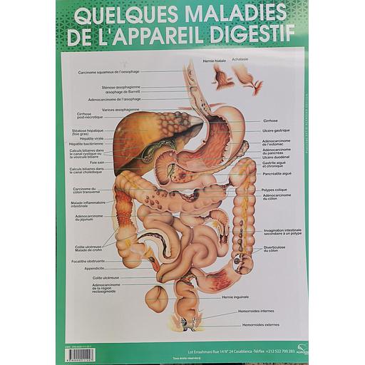 Poster "Quelques maladies de l'appareil digestif"