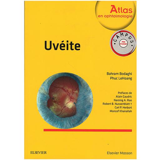 CAMPUS UVEITE