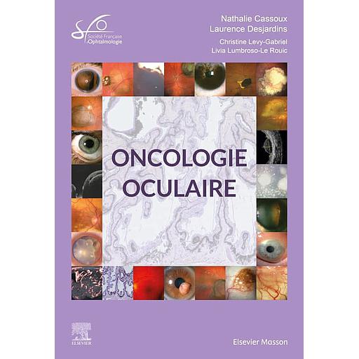 Oncologie oculaire