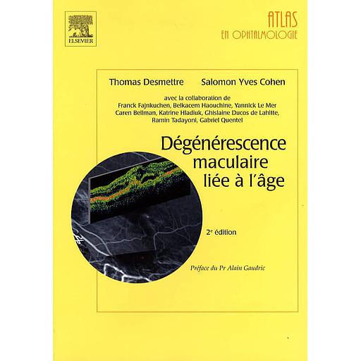 Dégénérescence maculaire liée à l'âge