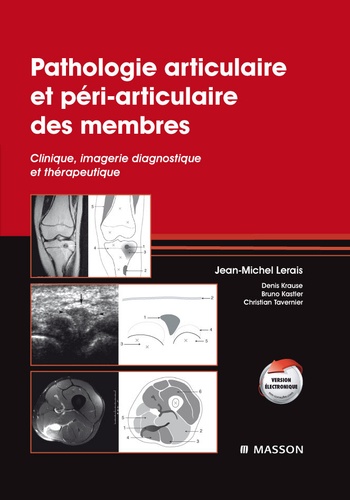 Pathologie articulaire et péri-articulaire des membres - Clinique, imagerie diagnostique et thérapeutique