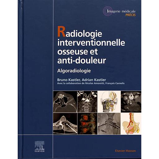 Radiologie Interventionnelle osseuse et anti-douleur - Algoradiologie
