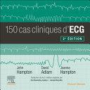 CAMPUS 150 CAS CLINIQUES D'ECG
