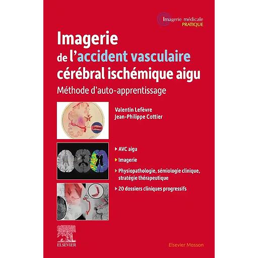 Imagerie de l'accident vasculaire cérébral ischémique aigu Edition Campus