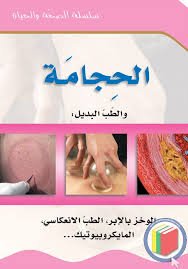 الحجامة