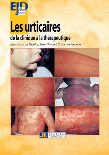 Les urticaires de la clinique à la thérapeutique