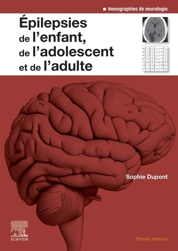 [9782294773266] Epilepsies de l'enfant, de l'adolescent et de l'adulte