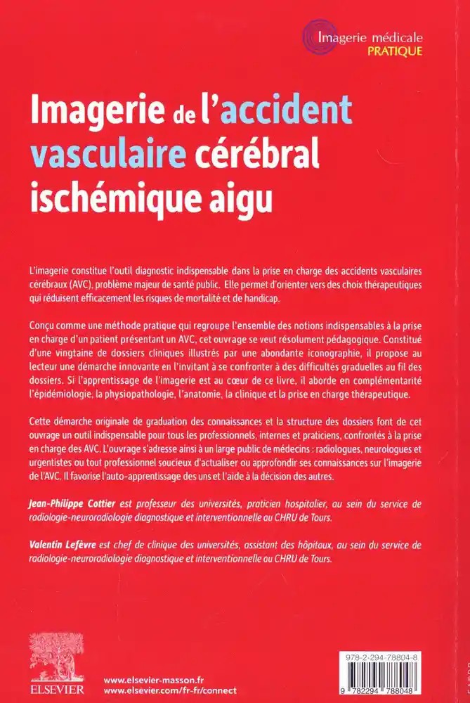 Imagerie de l'accident vasculaire cérébral ischémique aigu
